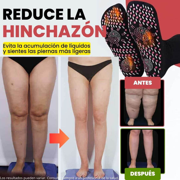 Calcetines Saludables AntiVarices