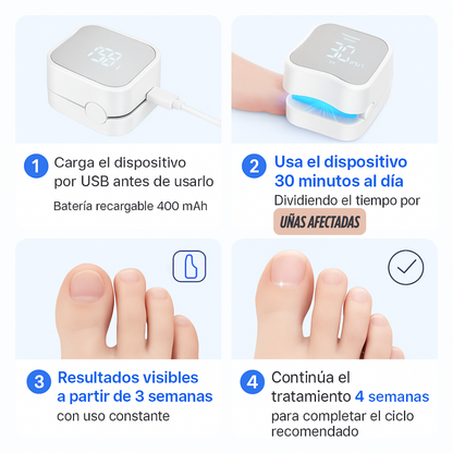 LaserNail Pro™ – Adiós a los Hongos en Tiempo Récord 💅✨