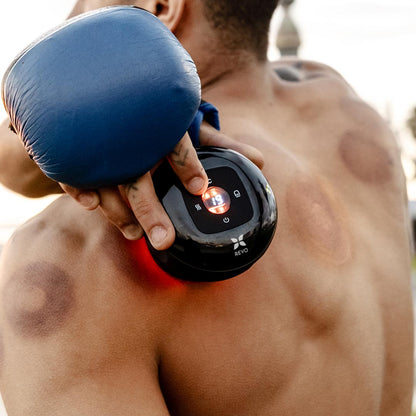 Ventosa Inteligente con Calor y Luz Roja Aluna™ | 🎁 ¡COMPRA 1 Y LLEVA 2 PARA USO EN DIFERENTES ZONAS DEL CUERPO!