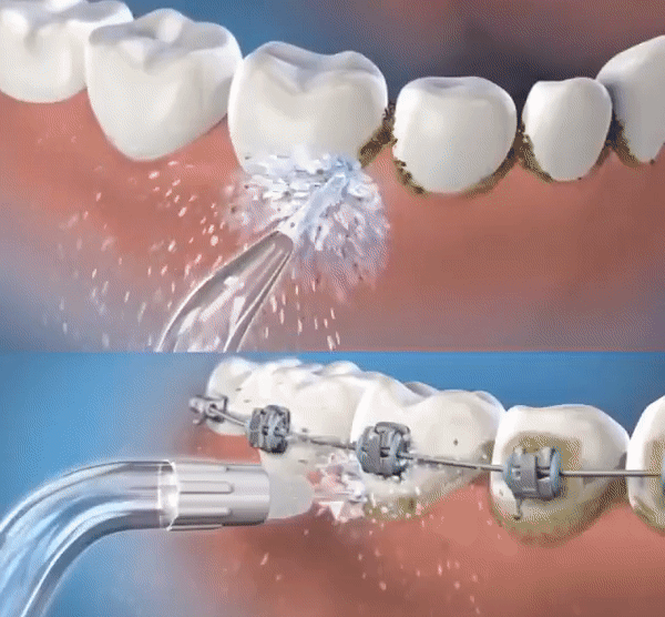 Irrigador Dental HidroDent