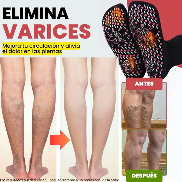 Calcetines Saludables AntiVarices
