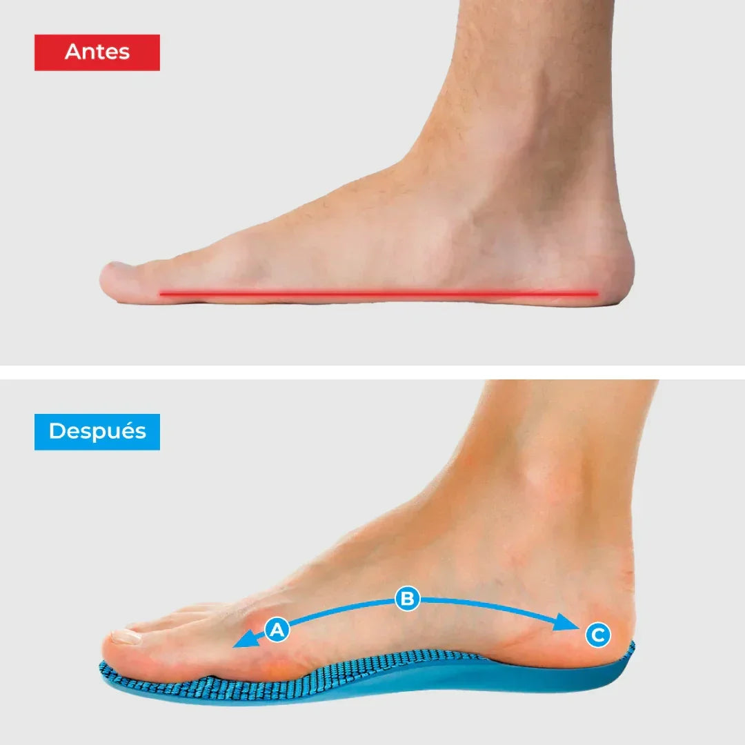 Comfyfeet™ – Plantillas terapéuticas para un alivio inmediato y natural 👣